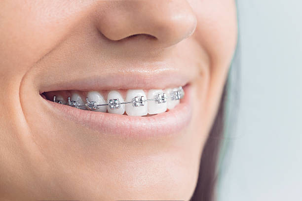 Best Traditional Braces  in West Laurel, MD